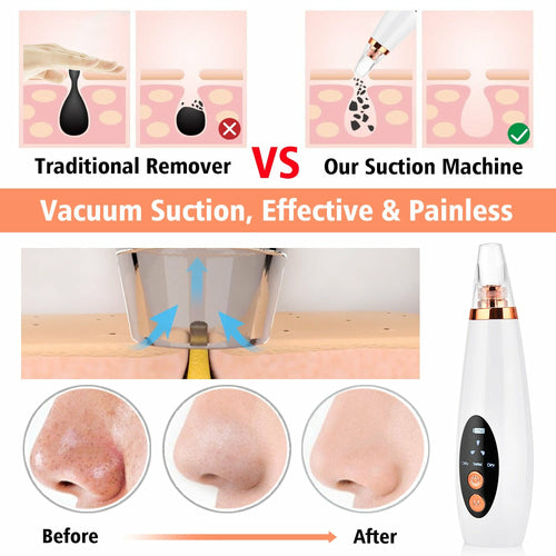Facial Pore Cleaner Blackhead Remover Skin Care Beauty Tool